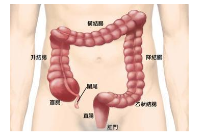 患上直肠癌病原因有什么